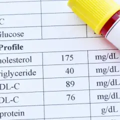 Wynik lipidogramu: cholesterol 175 mg/dL, HDL 89 mg/dL, LDL 76 mg/dL. Sprawdzam, czy cholesterol nie-HDL mieści się w normie.