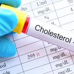 Jaki poziom cholesterolu jest odpowiedni dla wieku? Sprawdź normy i ryzyka