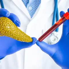 Lekarz w niebieskich rękawiczkach trzyma model trzustki i probówkę z krwią. Badanie amylazy co to jest, pomaga ocenić stan trzustki.