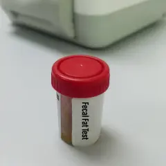 Pojemnik z próbką do badania na obecność tłuszczu w kale, który może wskazywać na biegunka tłuszczowa.