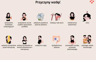 Ilustracja pokazuje przyczyny wzdęć, w tym dysbakteriozę jelitową, która może powodować gazy w jelitach.
