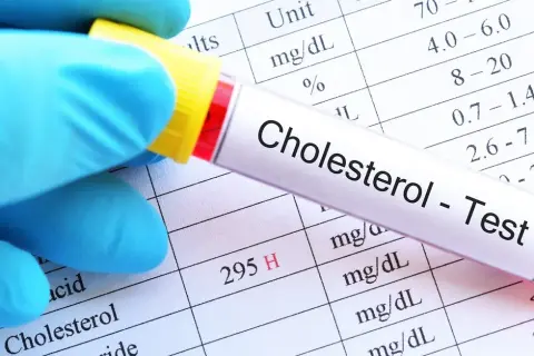 Jaki poziom cholesterolu jest odpowiedni dla wieku? Sprawdź normy i ryzyka
