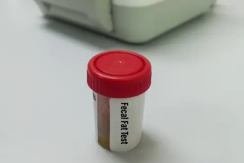 Pojemnik z próbką do badania na obecność tłuszczu w kale, który może wskazywać na biegunka tłuszczowa.