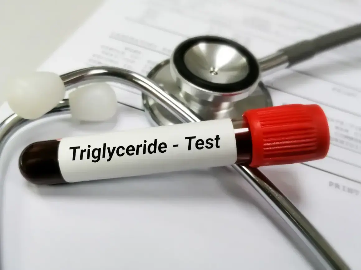 Probówka z krwią do badania trójglicerydów leży na stetoskopie. Wysokie trójglicerydy mogą wpływać na samopoczucie.
