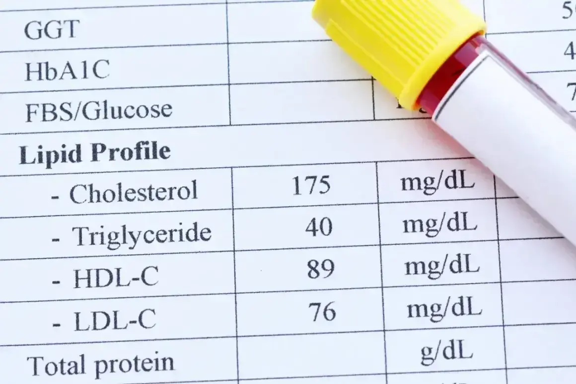 Wynik lipidogramu: cholesterol 175 mg/dL, HDL 89 mg/dL, LDL 76 mg/dL. Sprawdzam, czy cholesterol nie-HDL mieści się w normie.