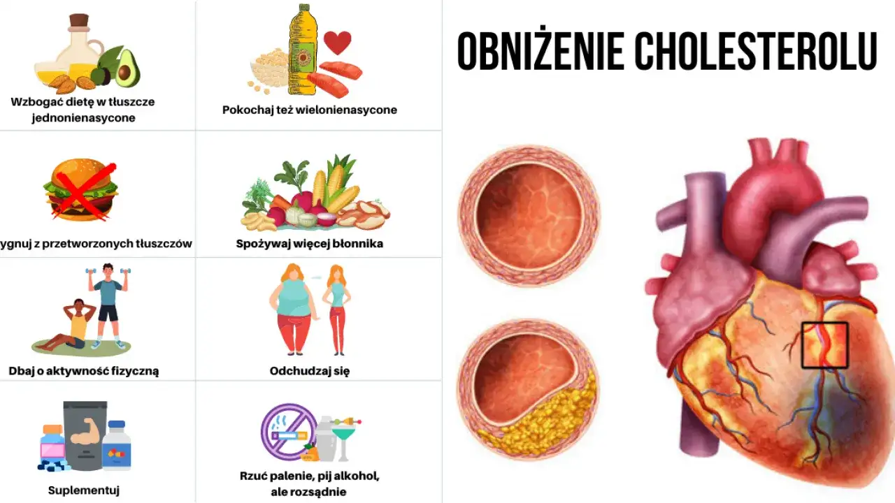 Zdjęcie Czy ostropest obniża cholesterol? Sprawdź naukowe dowody i efekty